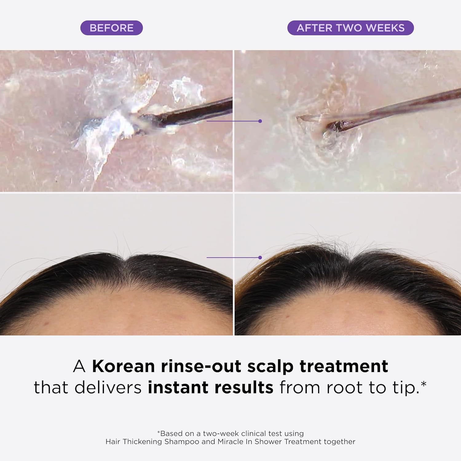 Dr. Groot Miracle in Shower Moisturizing Treatment for Hair Loss, Korean Hair Care Rinse, Rosemary Oil for Smooth, Healthier-Looking Hair in 5 Seconds, Scalp Revitalizing Solution