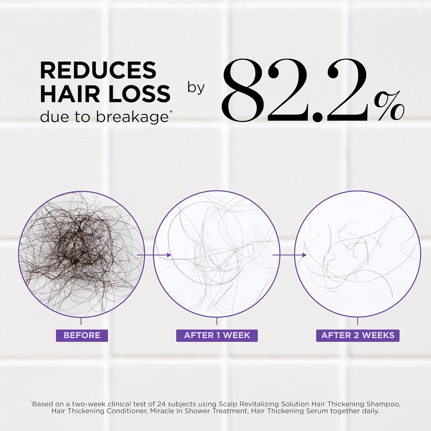 Dr. Groot Thickening Serum, Shampoo, Conditioner, and Scalp Treatment Set for Hair Loss – Clinical Results with Biotin and Rosemary for Hair Thinning, Shedding, Scalp Repair and Treatment