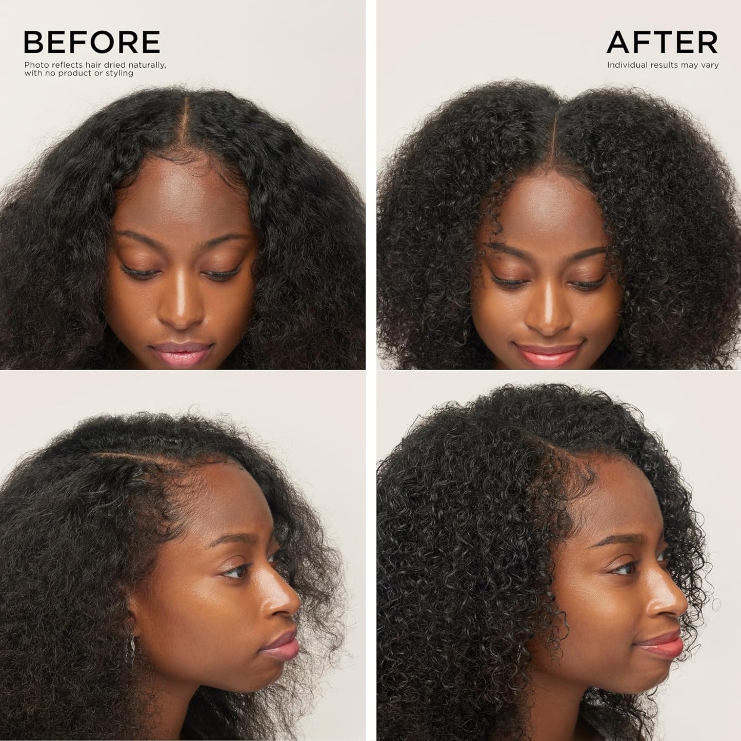 Dr. Groot Thickening Shampoo & Scalp Treatment Set for Hair Loss – Clinical Results with Biotin and Rosemary for Hair Thinning, Shedding, Scalp Repair and Treatment