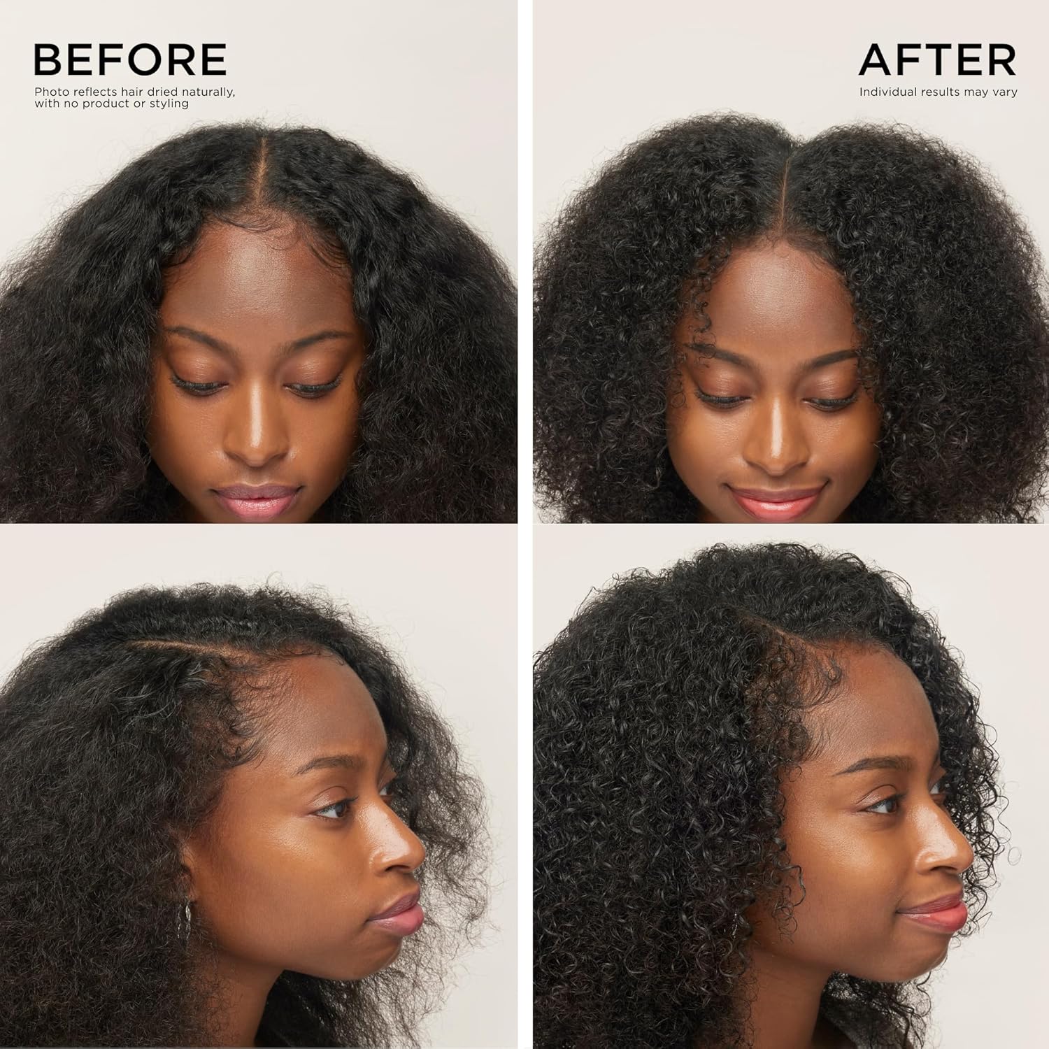 Dr. Groot Thickening Shampoo & Scalp Treatment Set for Hair Loss – Clinical Results with Biotin and Rosemary for Hair Thinning, Shedding, Scalp Repair and Treatment